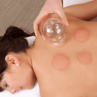 Cupping Therapy